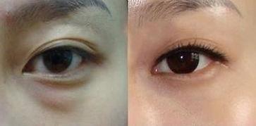 哪些明星做眼袋,从刘亦菲到范冰冰，探寻眼部护理之道